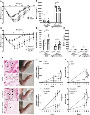 Insulin-regulated aminopeptidase contributes to setting the intensity of FcR-mediated inflammation